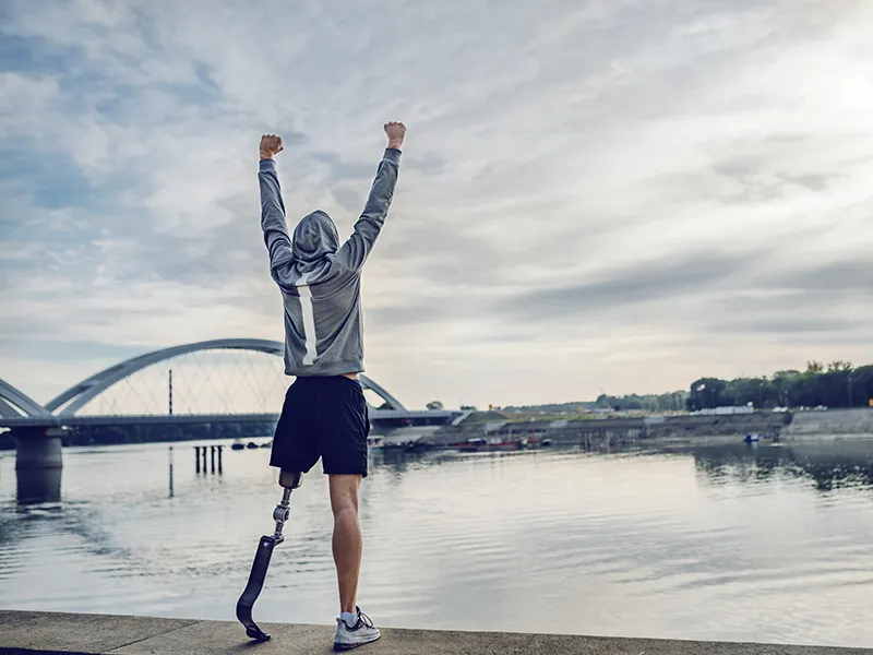 Man posing with new prosthetic – Gallery Man posing with new prosthetic